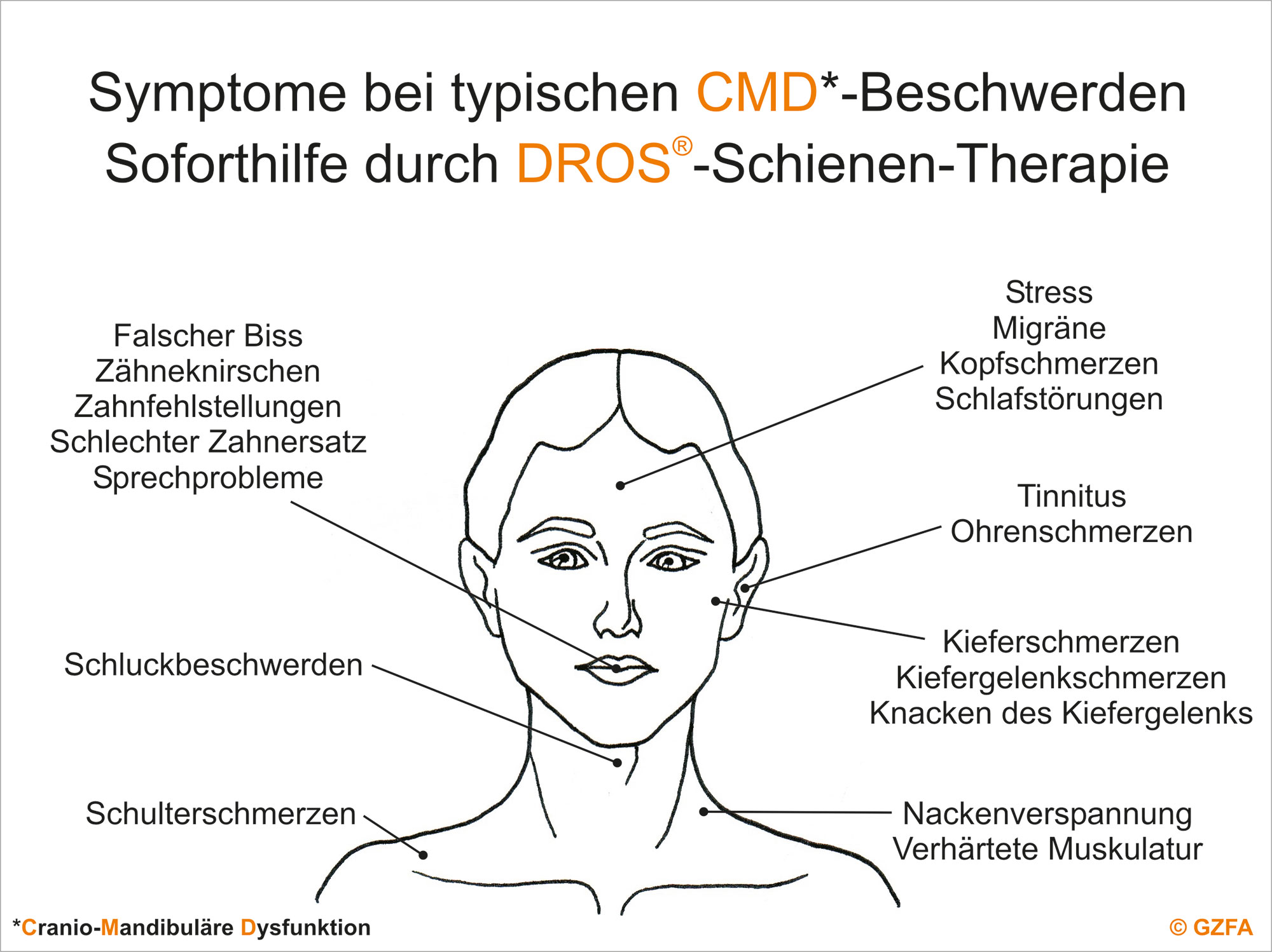 Symptome bei typischen CMD-Beschwerden – Soforthilfe durch DROS®-Schienentherapie in Bautzen.