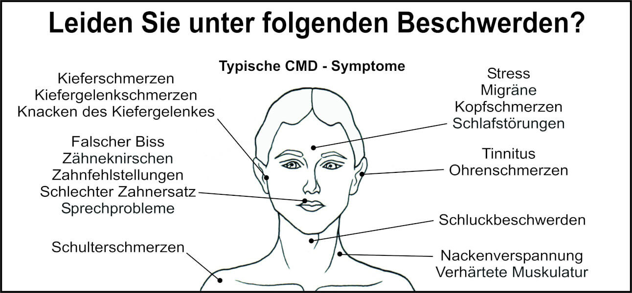 CMD Ärzte helfen bei typischen Symptomen wie Zahnfehlstellungen, Kopf- und Kieferschmerzen, Ohrenschmerzen, Tinnitus und Muskelverspannungen.