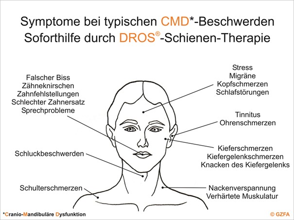 Symptome bei typischen CMD-Beschwerden – Soforthilfe durch DROS®-Schienentherapie in Potsdam.