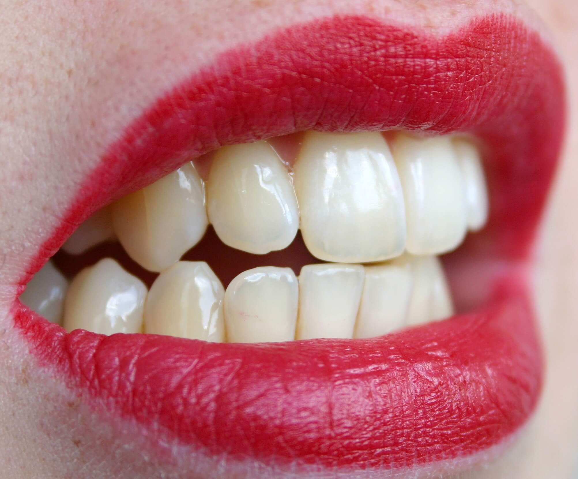 Dental Wellness: Schöne Zähne.