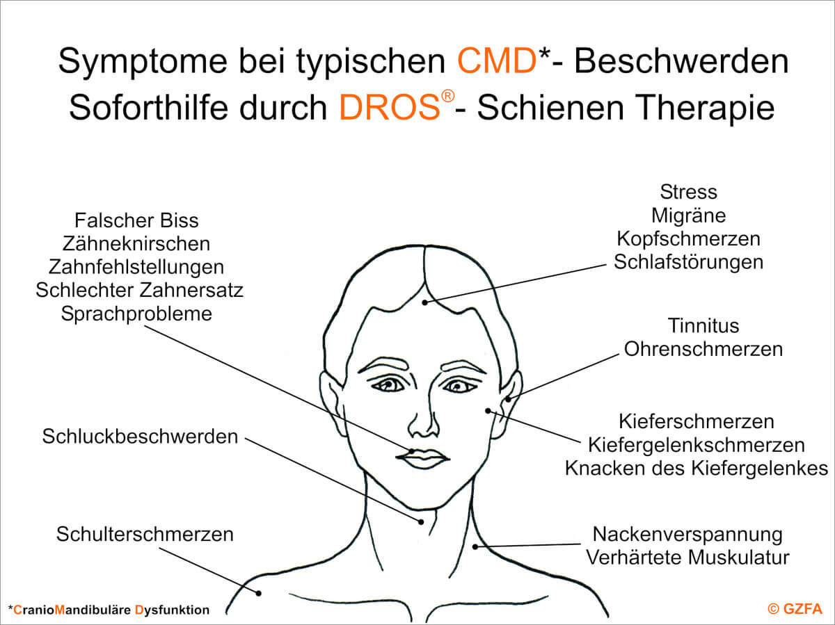 Unterschiedliche Symptome bei CMD-Beschwerden: Soforthilfe durch die DROS®-Schienentherapie.