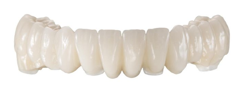 Zahnarzt-Zweitmeinung Sprechstunde: Fragen sie ihren Zahnarzt, mit welchem Dentallabor er zusammenarbeitet?