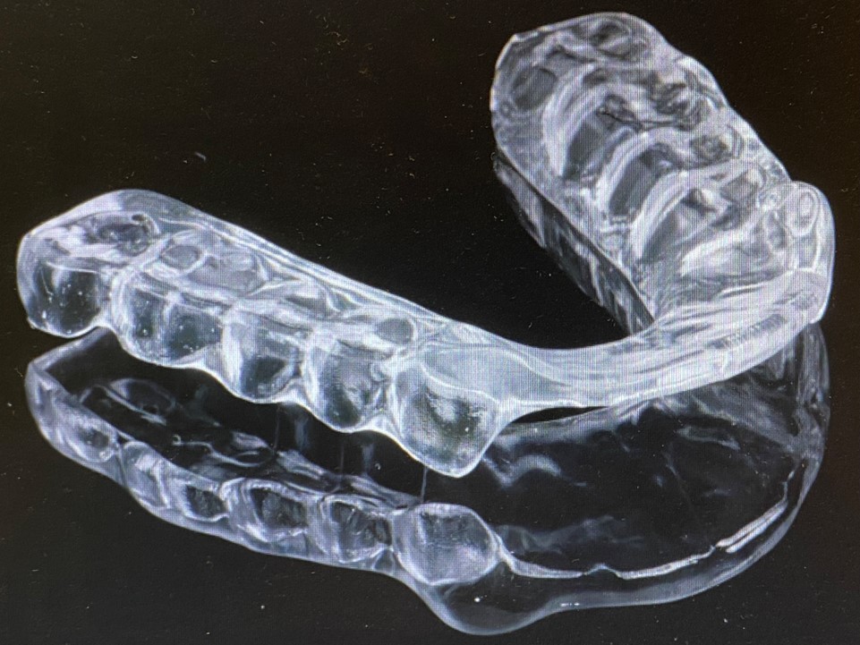Michigan-Schiene für den Oberkiefer als einphasige Schiene.
