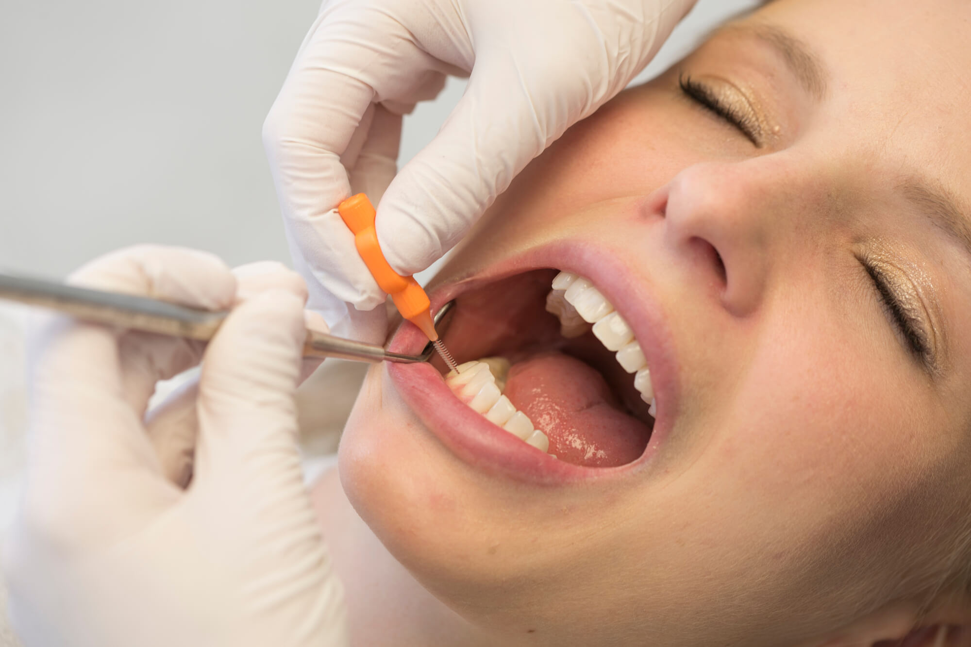 Prophylaxe-Behandlung beim Zahnarzt die erheblich zur langfristigen Zahngesundheit beiträgt.
