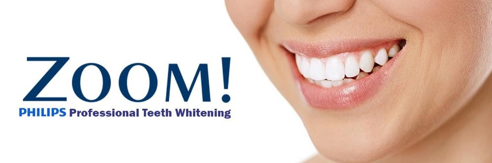 Bleaching-Sprechstunde: Professionelle Zahnaufhellung mit dem Philips Zoom - Wieviel Weiß ist noch gesund?