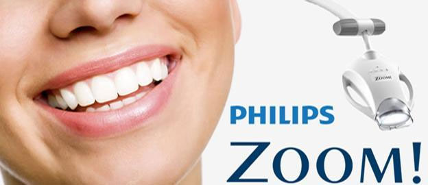 Zahnaufhellung: Helle Zähne für eine positive Ausstrahlung