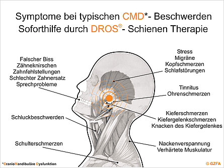 Beschwerdebilder aus der Zahnheilkunde: Überschneidung von Medizin und Zahnmedizin. Beschwerdebilder aus der Zahnheilkunde: Überschneidung von Medizin und Zahnmedizin.