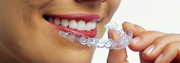 CA® CLEAR ALIGNER: Die „unsichtbare“ Zahnkorrekturschiene. Die CLEAR ALIGNER Schiene für die Behandlung von Zahnfehlstellungen bei Erwachsenen.
CA® CLEAR ALIGNER: Die „unsichtbare“ Zahnkorrekturschiene.
Bildquelle: ©SCHEU-DENTAL GmbH