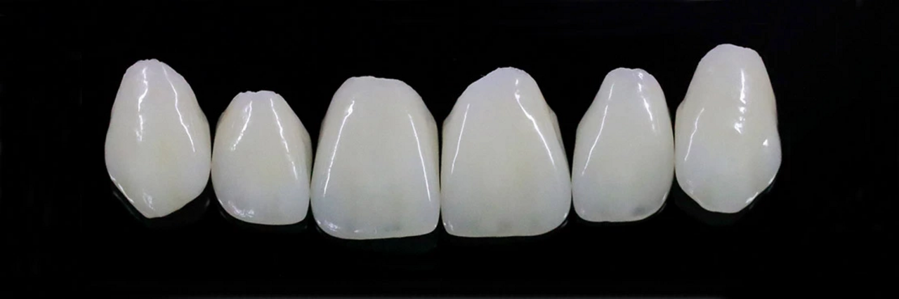 Ein Bild von Keramik-Veneers auf schwarzem Hintergrund