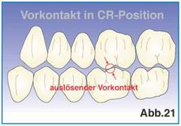Okklusion in der Zahnmedizin
