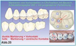 Okklusion in der Zahnmedizin
