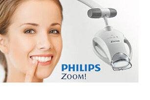 Bleaching mit Philips ZOOM. Bleaching mit Philips ZOOM.