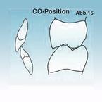 Abb. 15 zeigt eine harmonische Okklusion (CO = Complete Occlusion)